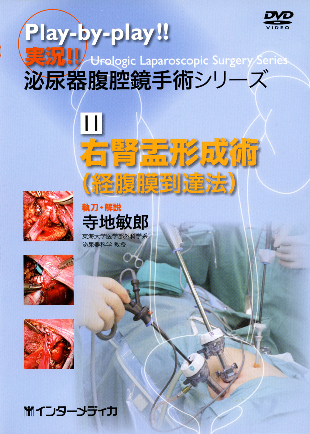 小柳弐魄の【DEEPCORE TOUCH～禁断の施術法～】 11.右腎盂形成術（経腹膜到達法） - インターメディカ 医学・看護