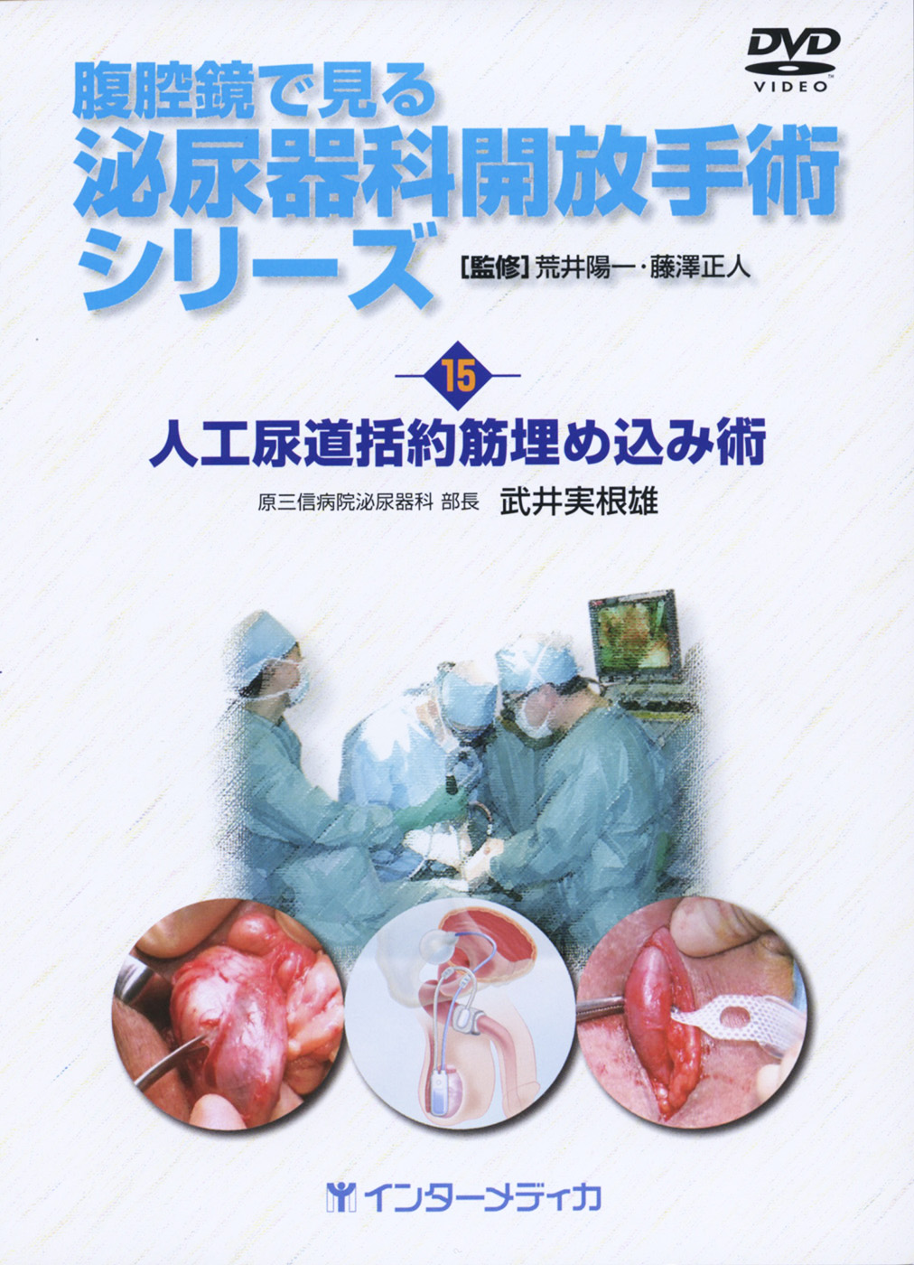 括約筋 15.人工尿道括約筋埋め込み術 - インターメディカ 医学・看護・介護分野の映像・出版・eラーニング