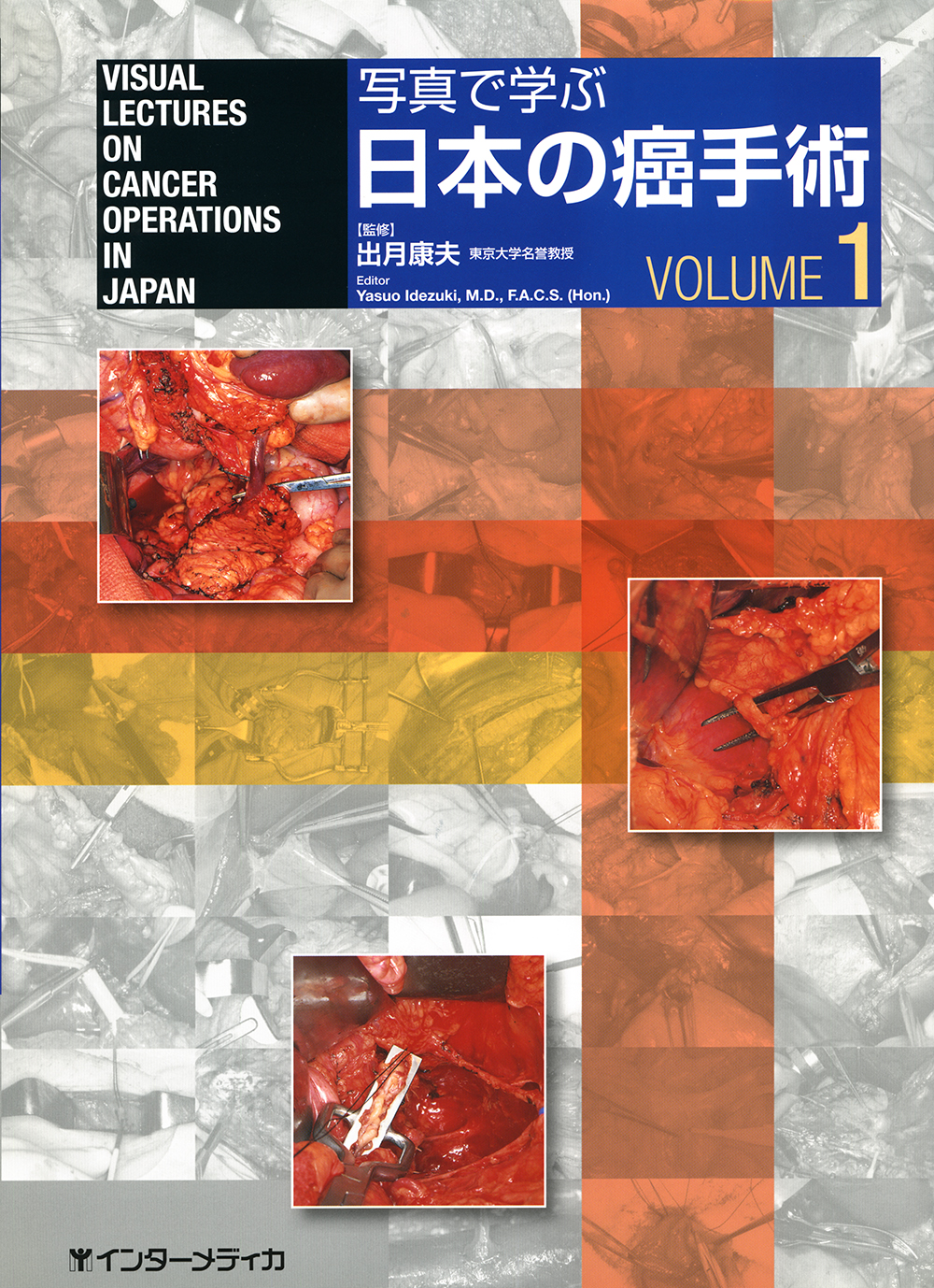 写真で学ぶ 日本の癌手術 vol.1 - インターメディカ 医学・看護・介護