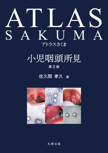 アトラスさくま 小児咽頭所見 第2版 - 丸善出版 理工・医学・人文社会
