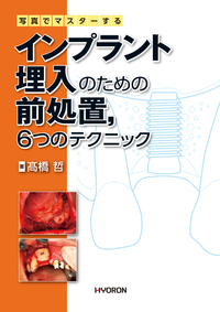 写真でマスターする 支台歯形成の基本テクニック - 株式会社