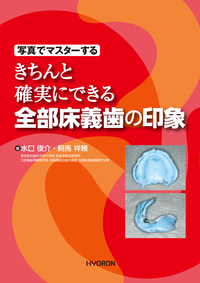 写真でマスターする 顎関節症治療のためのスプリントのつくり方